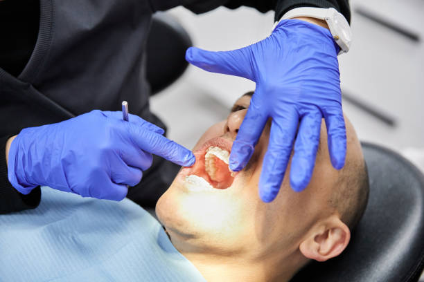 Best Dentist for Tooth Abscess  in New London, CT